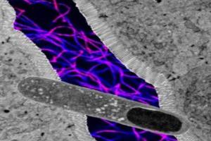 Gut Bacteria: ਅਮਰੀਕੀ ਵਿਗਿਆਨੀਆਂ ਨੇ ਖੋਜਿਆ ਅਜਿਹਾ ਗਟ ਬੈਕਟੀਰੀਆ ਜੋ ਭਾਰ ਘਟਾਉਣ ਵਿੱਚ ਵੀ ਮੱਦਦਗਾਰ